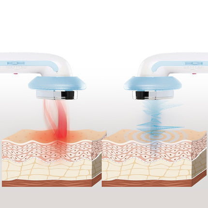 3-in-1-Anti-Cellulite-Massagegerät mit Ultraschallkavitation, Infrarot und Elektrostimulation CellyMax InnovaGoods